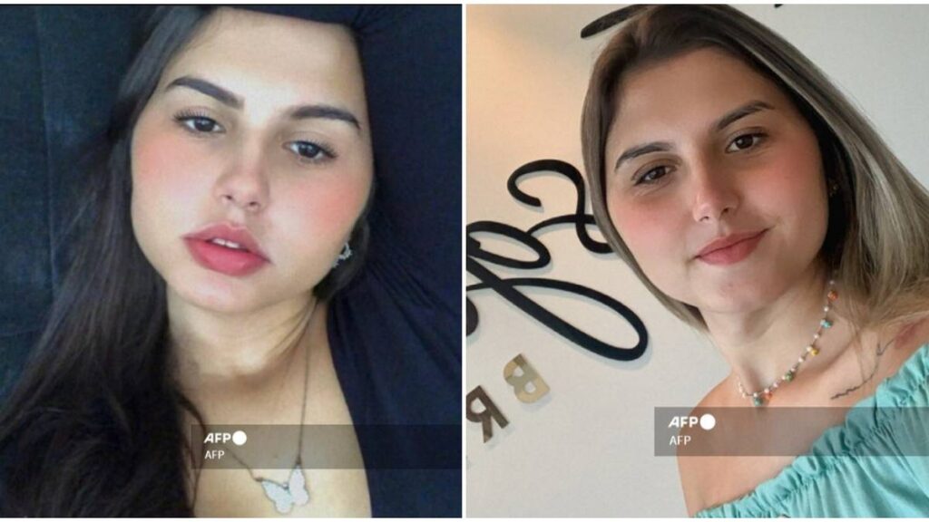 Gemelas trans en Brasil se someten juntas a cirugía de reasignación de sexo